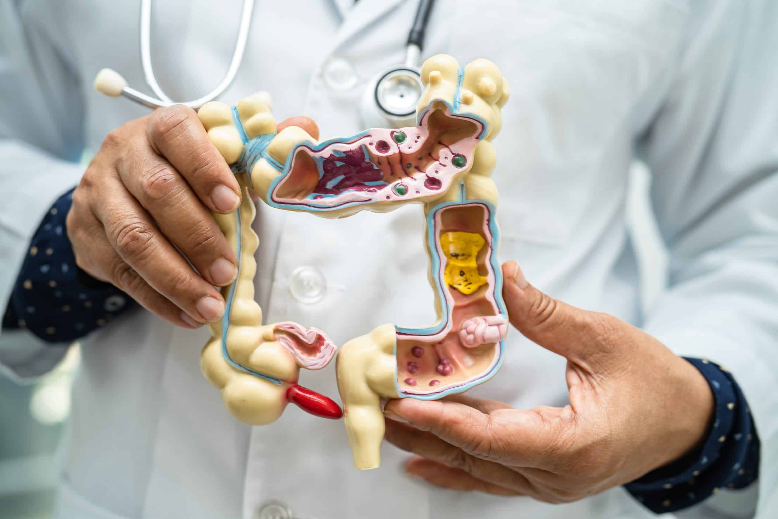Microbiota intestinal apresenta papel imortante no processo de emagrecimento