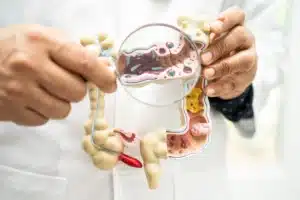 Microbioma gástrico e obesidade: representação científica das bactérias presentes no estômago e de sua relação com o metabolismo e a cirurgia bariátrica.
